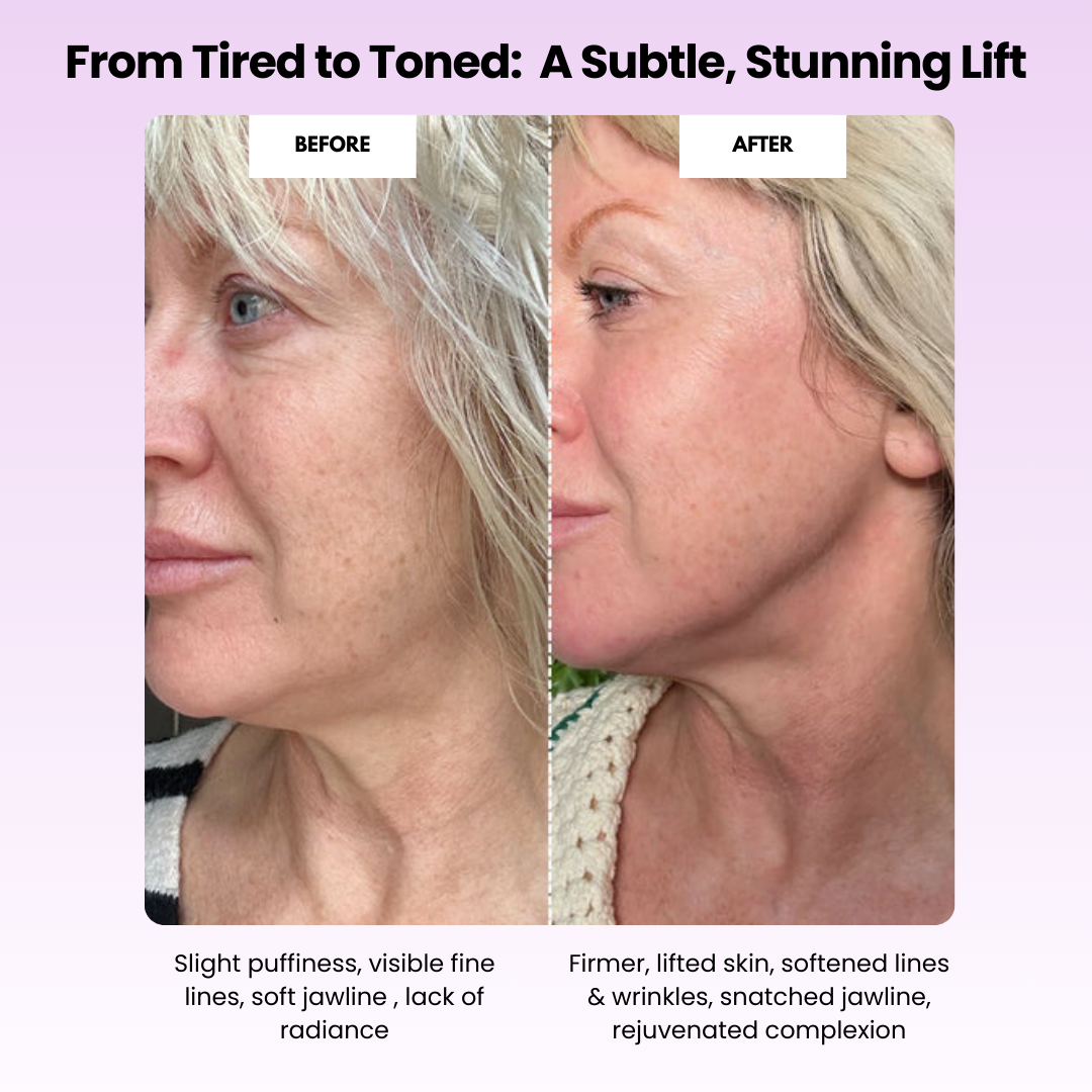 Lunimo™ Glow Sculpt - Beauty Roller