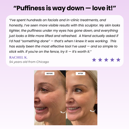 Lunimo™ Glow Sculpt - Beauty Roller